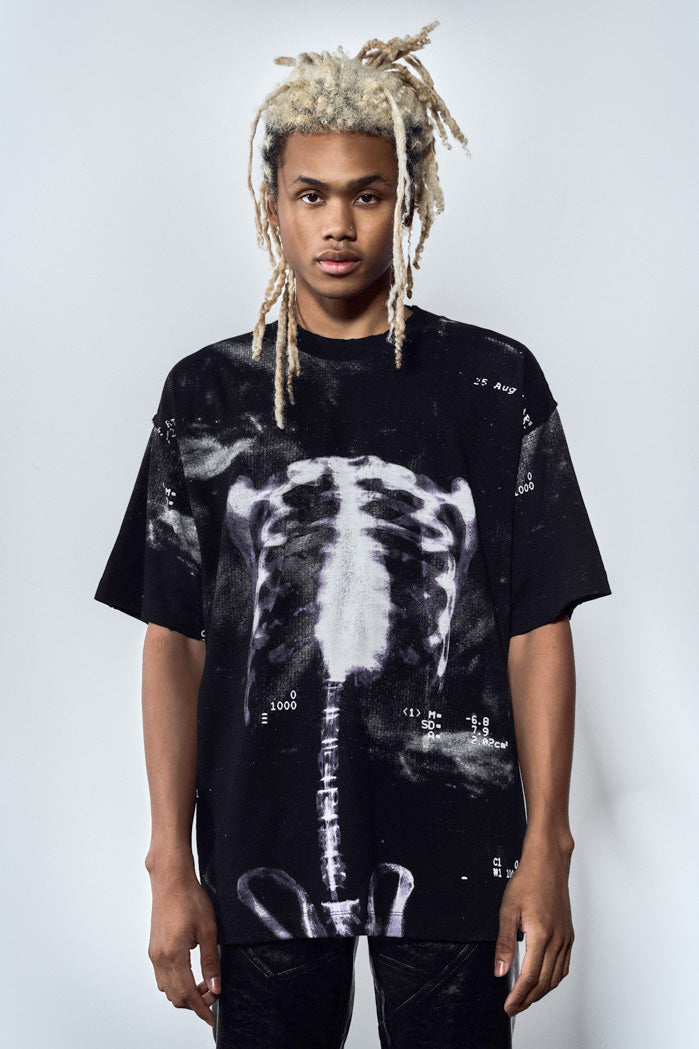 Ribcage x-ray printed black t-shirt 